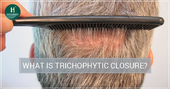 trichophytic closure