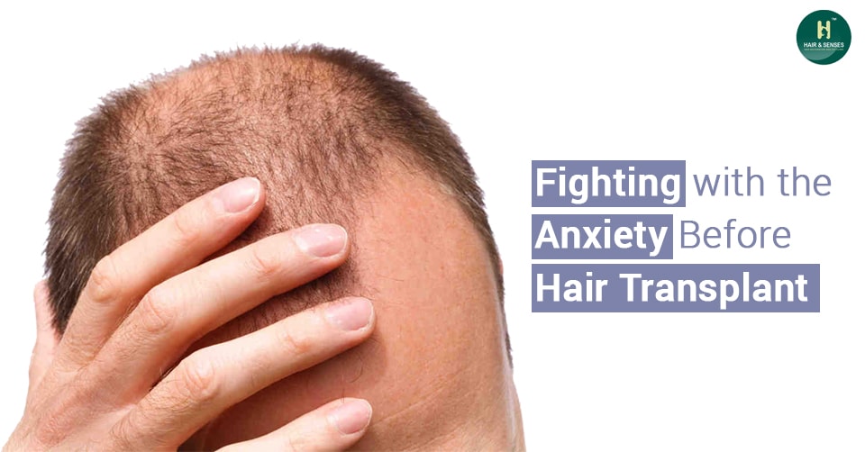 Anxiety before Hair Transplant