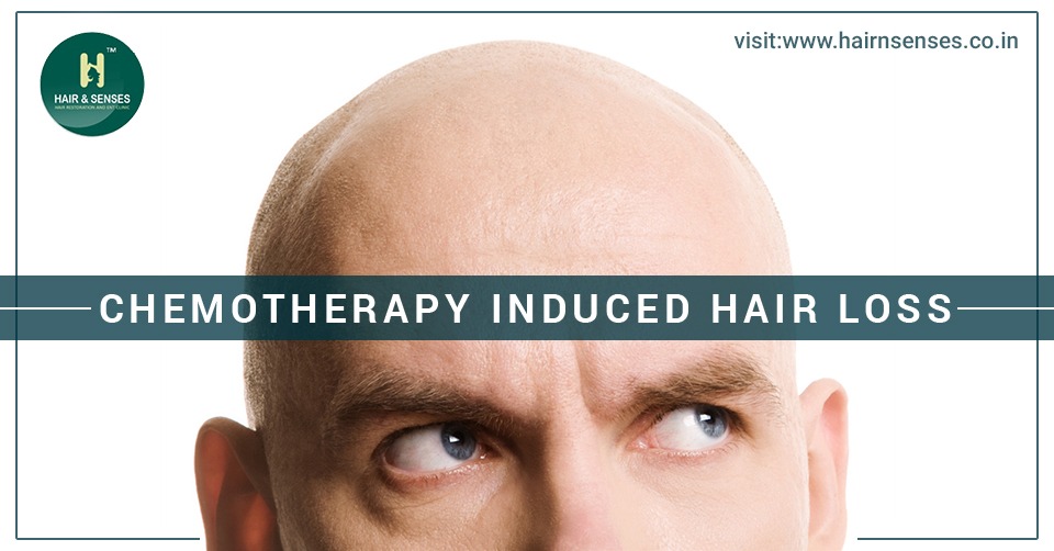 Chemotherapy induced hair loss
