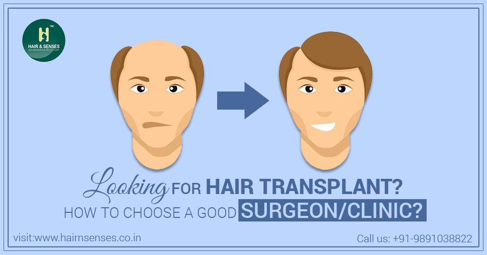 Good Clinic for Hair Transplant