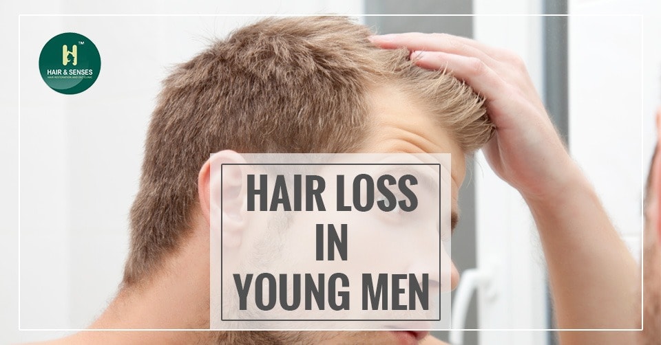 Hair Loss in young men