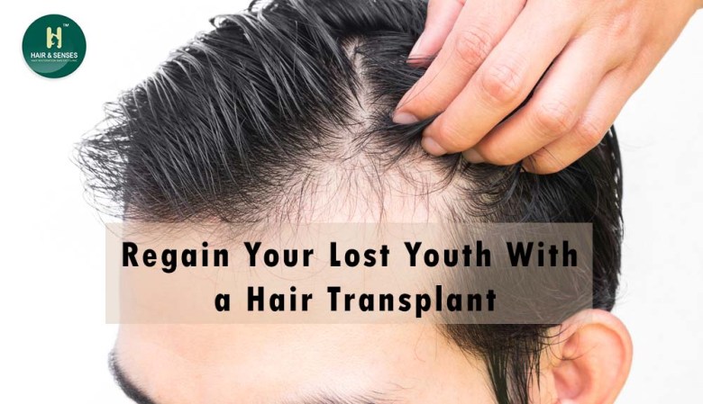 Regain Youth with Hair Transplant