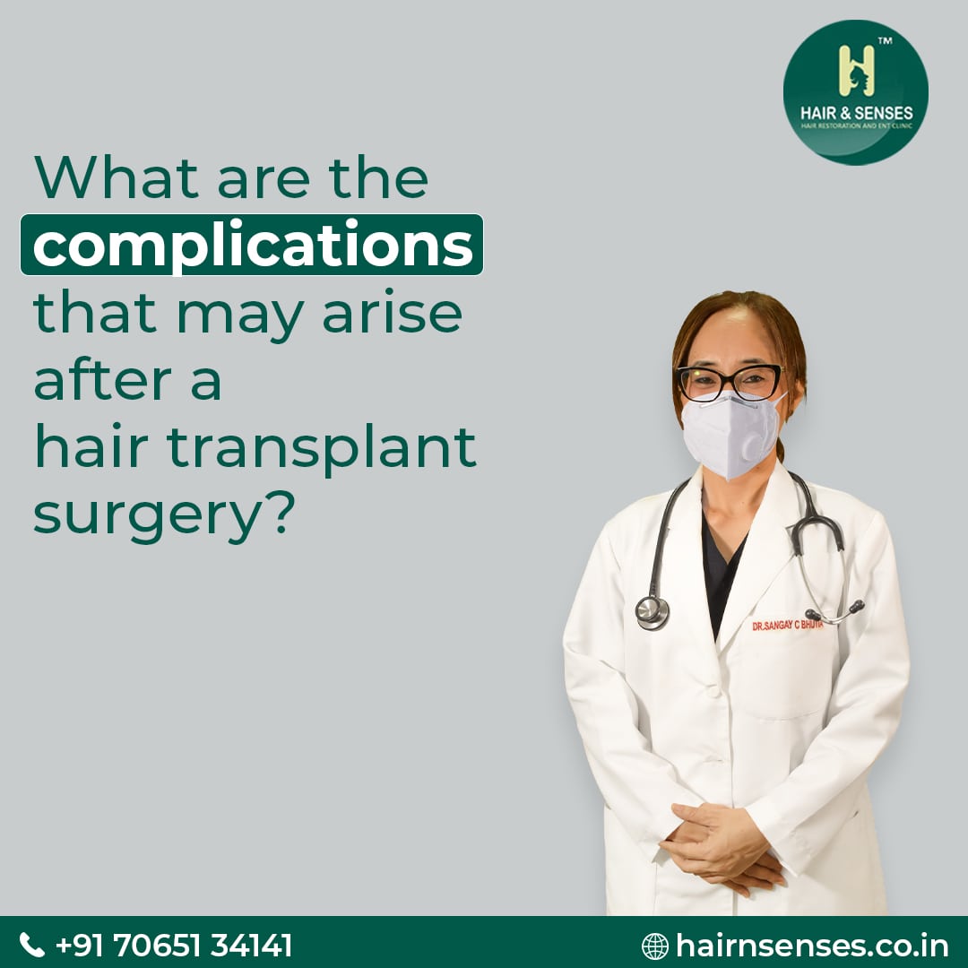 Complications after hair transplant surgery Hair Transplant Risks and
