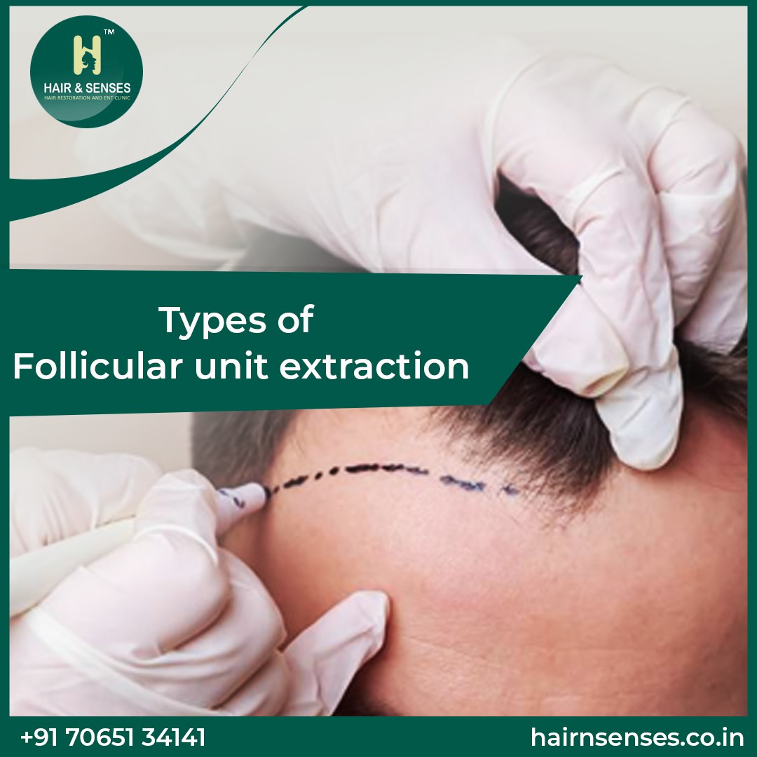 Hair Loss Treatment