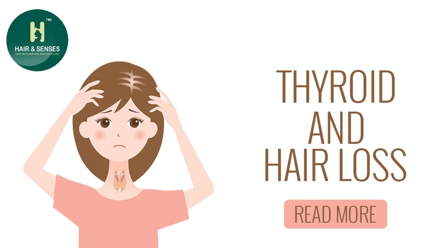 Thyroid hair loss